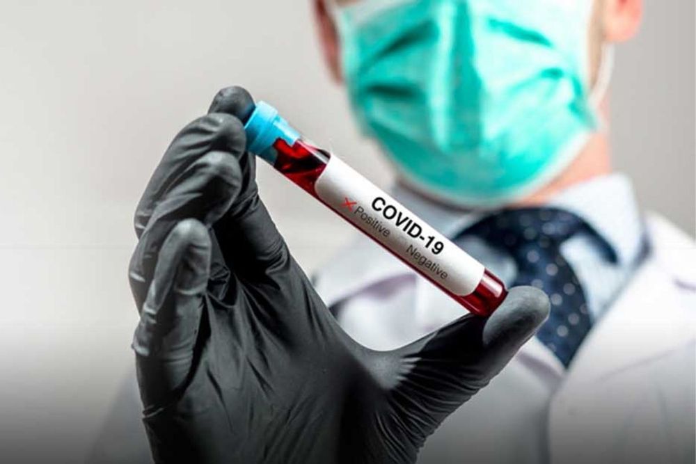 Updated measures to combat COVID-19 in federal government entities revealed