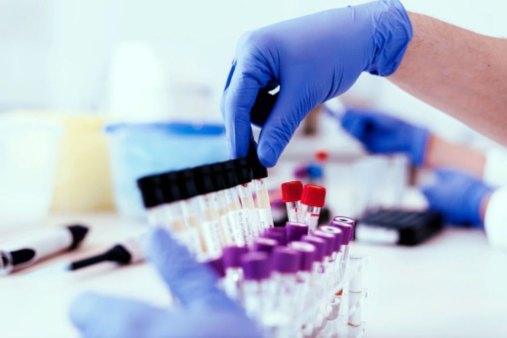 AED100,000 fine, jail for declining to give sample for drug test