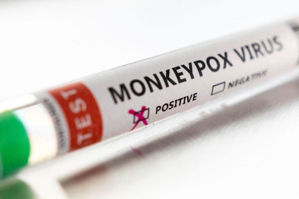 High-risk contacts of Monkeypox in UK told to isolate for 21 days