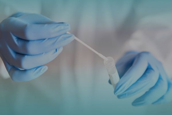 Pakistan to limit PCR Test Validity to 48-hours for nationals travelling from UAE